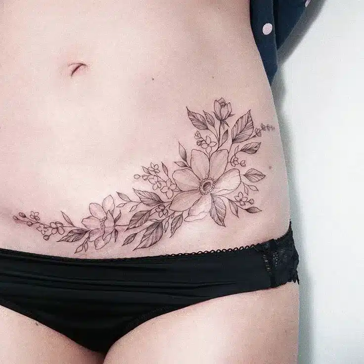 Floral Wraps for Surgical Scars